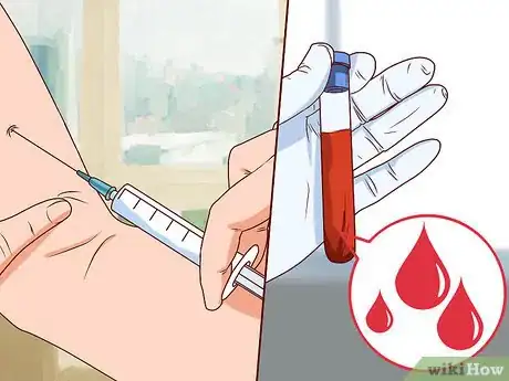 Image titled Diagnose Lupus Step 10