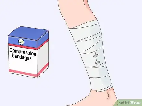 Image titled Get Rid of Bruises Step 3