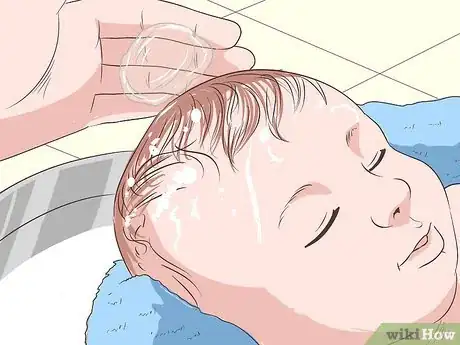 Image titled Heal Scalp Eczema Step 21