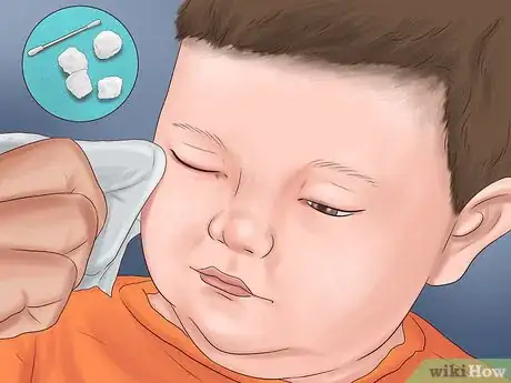 Image titled Administer Eye Drops in Children Step 12