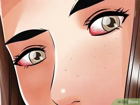 Image titled Reduce Bags Under Your Eyes Step 11