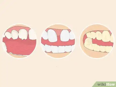 Image titled Fix Crooked Teeth Step 13