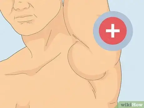 Image titled Help a Seroma Reabsorb Step 11