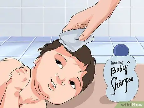 Image titled Prevent Cradle Cap Step 11