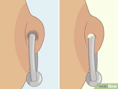 Image titled Care for a Nipple Piercing Step 4