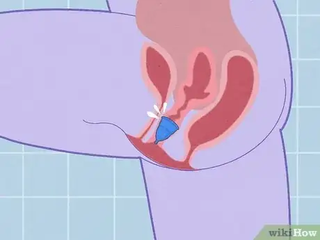 Image titled Use a Menstrual Cup Step 9