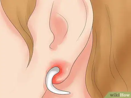 Image titled Take Care of Infection in Newly Pierced Ears Step 1