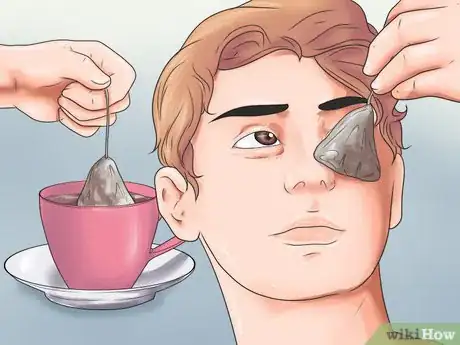 Image titled Get Rid of Bags Under Your Eyes Step 4