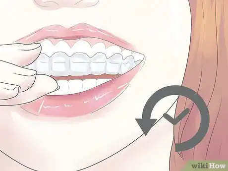 Image titled Cope with Teeth Whitening Sensitivity Step 7