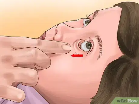 Image titled Administer Eye Drops in Children Step 13