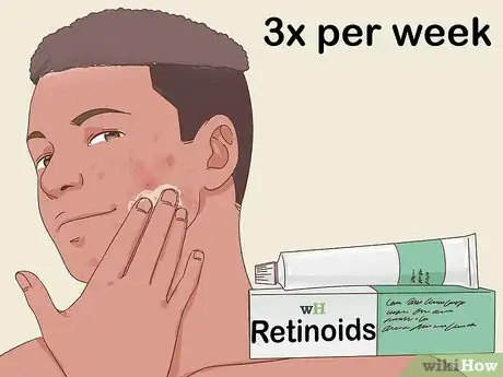 Image titled Treat Nodular Acne Step 3