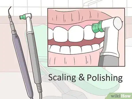 Image titled Clean Your Gums Step 9