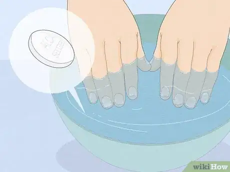 Image titled Get Rid of White Spots on Your Nails Step 6