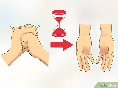 Image titled Stop Cracking Your Knuckles Step 12