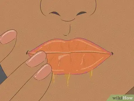 Image titled Make Lips Look Bigger Step 9