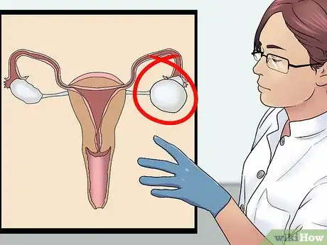 Image titled Know if You Have an Ovarian Cyst Step 10