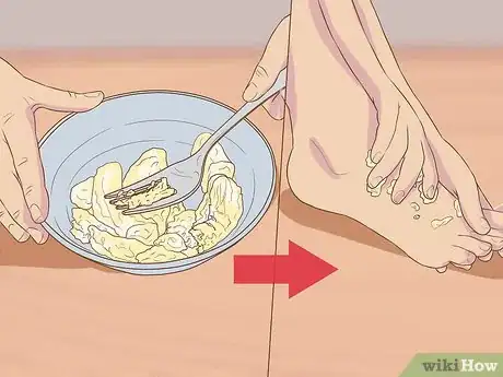 Image titled Remove Dead Skin from Feet Step 1