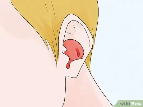 Image titled Cover Your Ears While Swimming Step 2