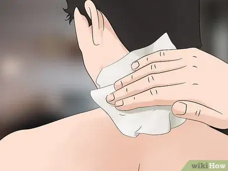 Image titled Avoid Yellow Stains on White Shirts Step 2