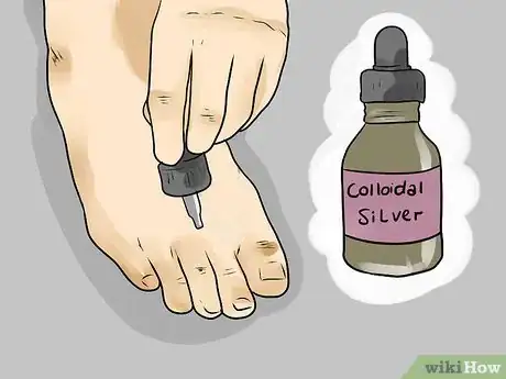 Image titled Use Apple Cider Vinegar for Athlete's Foot Step 10