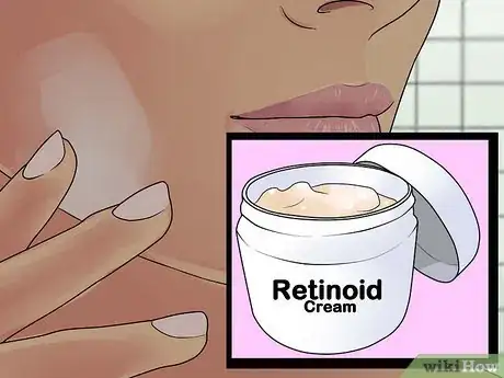 Image titled Prevent Acne Scars Step 19