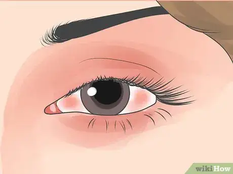 Image titled Stop Your Eye or Eyebrow from Jumping Step 12