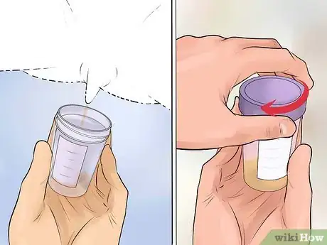 Image titled Help a Male Child Provide a Urine Sample Step 25