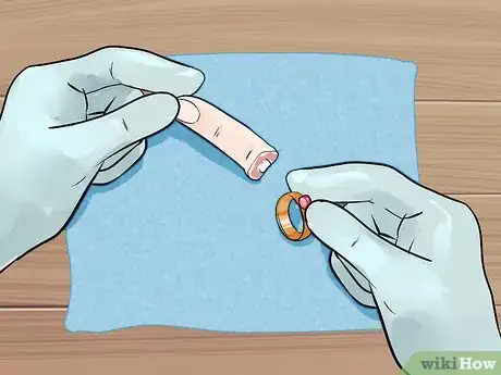 Image titled Give First Aid for a Severed Finger Step 13