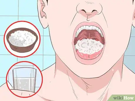 Image titled Remove Tonsil Stones (Tonsilloliths) Step 13