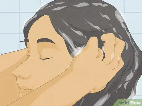 Image titled Make Your Scalp Stop Itching Step 1