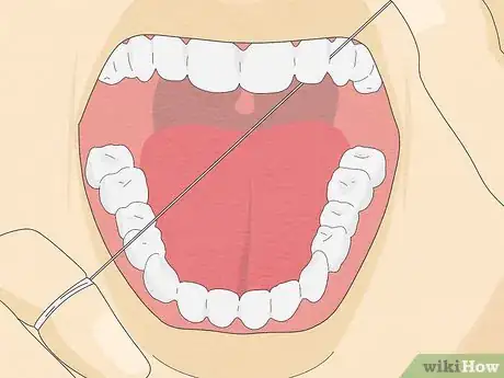 Image titled Fix Rotting Teeth Step 13