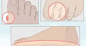 Get Healthy, Clean and Good Looking Feet