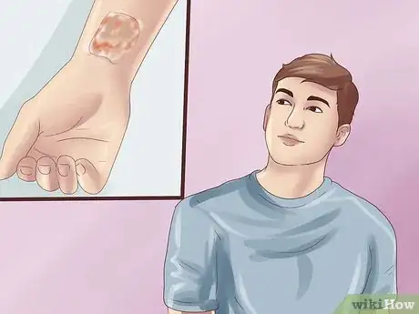 Image titled Remove a Tattoo at Home With Salt Step 3