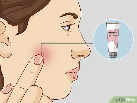 Image titled Take Care of Your Face (Females) Step 11