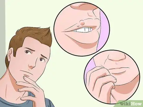 Image titled Heal Cold Sores Step 1