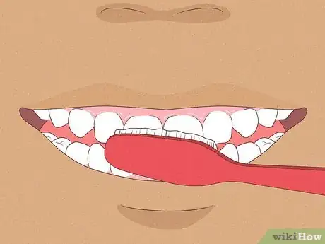 Image titled Cope with Twin Block Braces Step 10