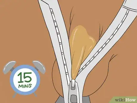 Image titled Free a Penis from a Stuck Zipper Step 12