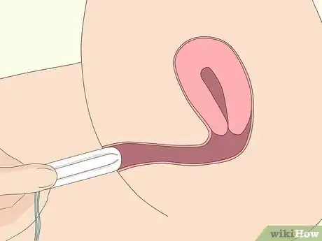 Image titled Insert a Tampon Without Applicator Step 6