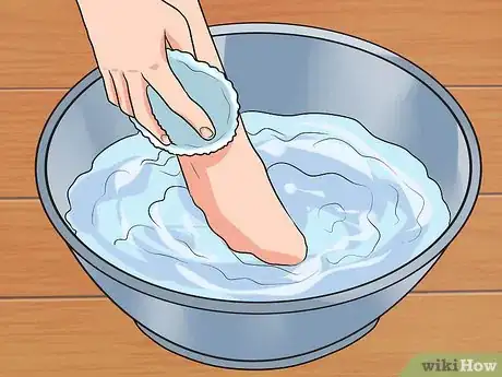 Image titled Tape a Foot for Plantar Fasciitis Step 2