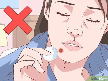 Image titled Stop a Zit from Bleeding Step 10