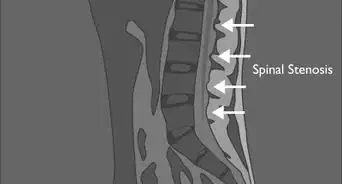 Read a Lumbar MRI