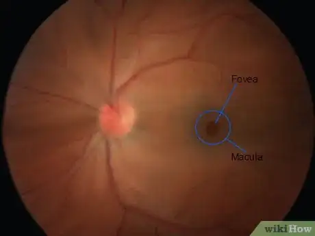 Image titled Use an Ophthalmoscope Step 15