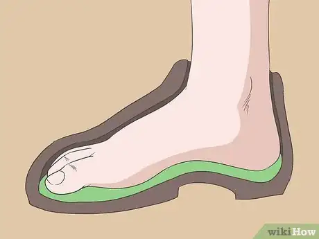 Image titled Cure Arthritis in Feet Naturally Step 20