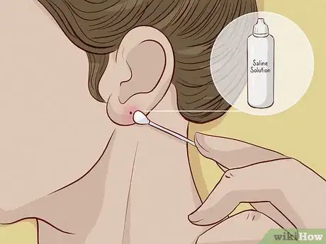 Image titled Close an Earlobe Piercing Step 2