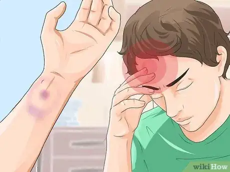 Image titled Know if a Pet Bite Is Serious Step 5