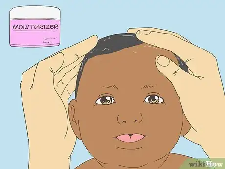 Image titled Get Rid of Cradle Cap Step 7