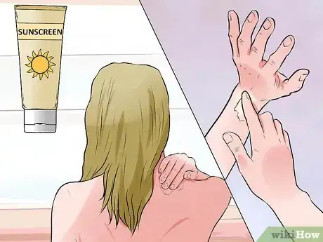 Image titled Use Sunbeds Step 15