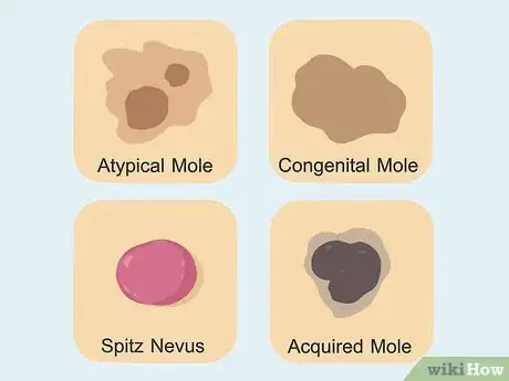 Image titled Get Rid of Moles on Your Face Step 3