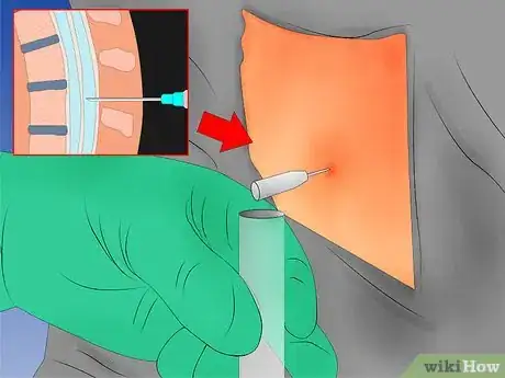 Image titled Diagnose Multiple Sclerosis Step 6