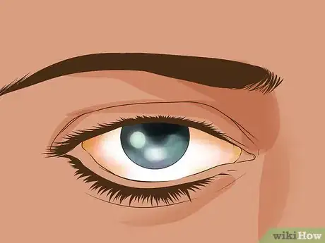 Image titled Know if You Are Ready for Contact Lenses Step 4